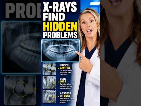 The Truth About Digital Dental X-rays and Radiation #oralhealth